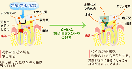 ２Ｍｉｘ法について
