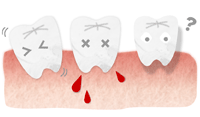 歯周病とは